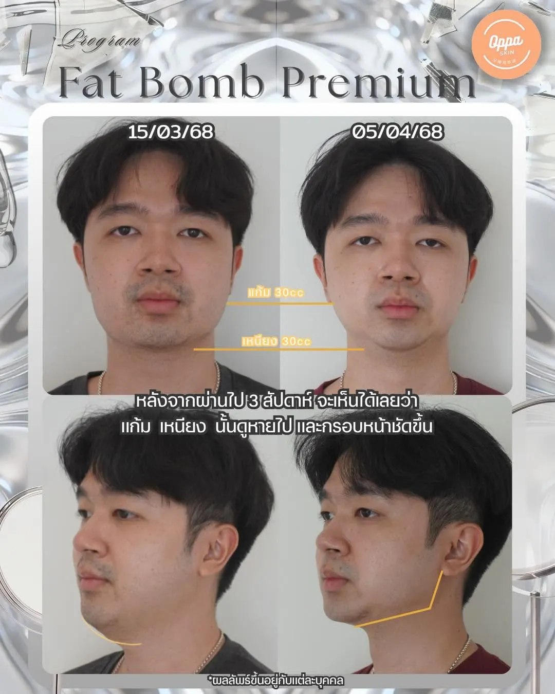 Oppa Skin Clinic คลินิกดูแลผิวและความงาม ย่านอารีย์ ใกล้ BTS อารีย์