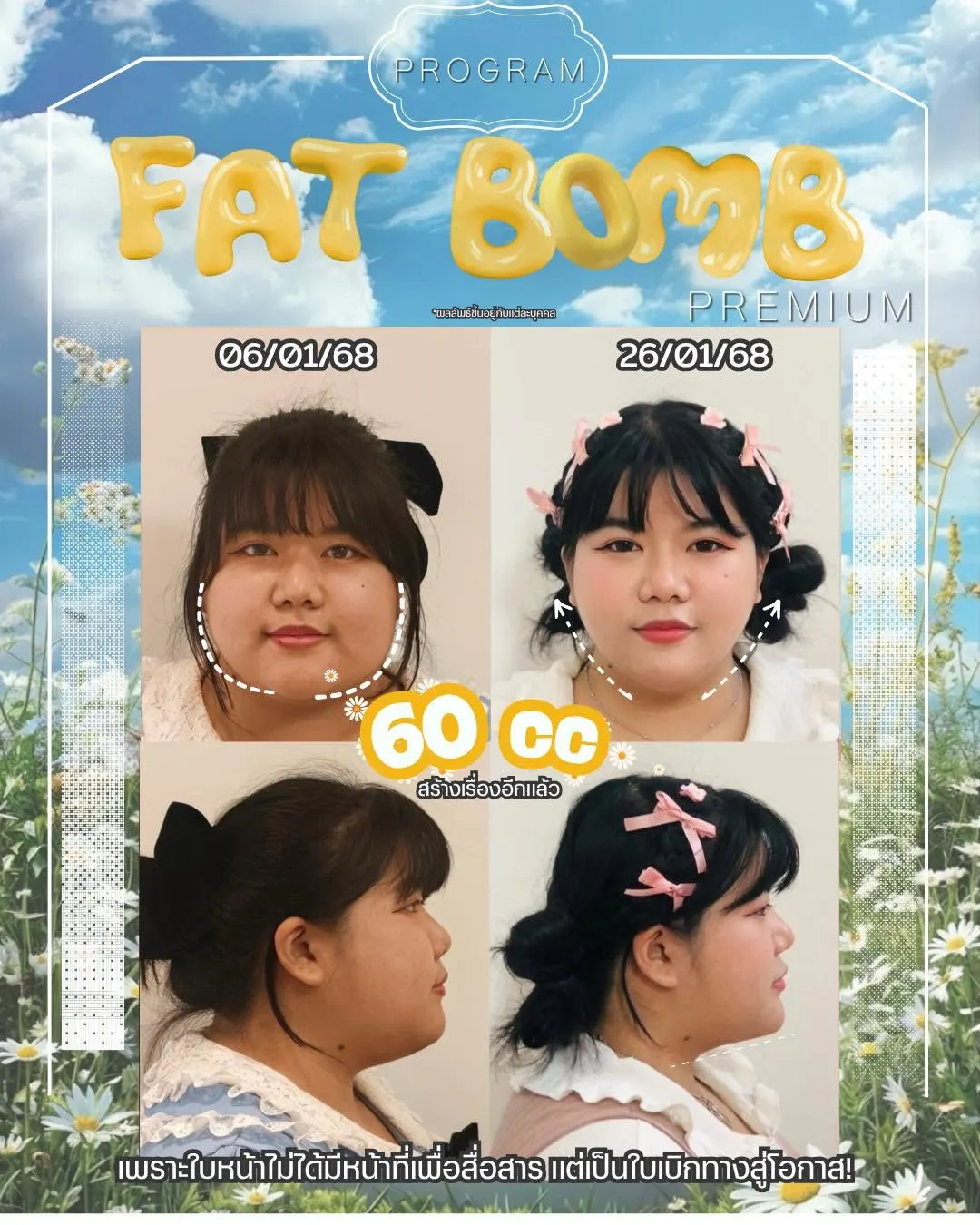 Oppa Skin Clinic คลินิกดูแลผิวและความงาม ย่านอารีย์ ใกล้ BTS อารีย์