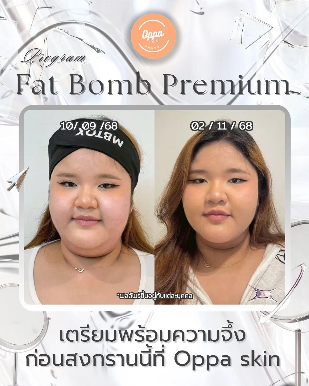 Oppa Skin Clinic คลินิกดูแลผิวและความงาม ย่านอารีย์ ใกล้ BTS อารีย์