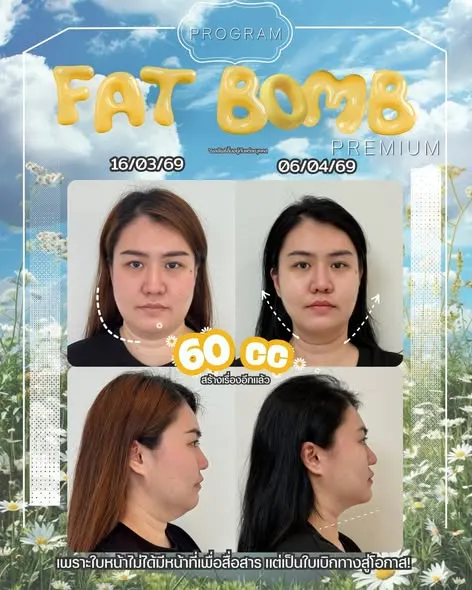 Oppa Skin Clinic คลินิกดูแลผิวและความงาม ย่านอารีย์ ใกล้ BTS อารีย์