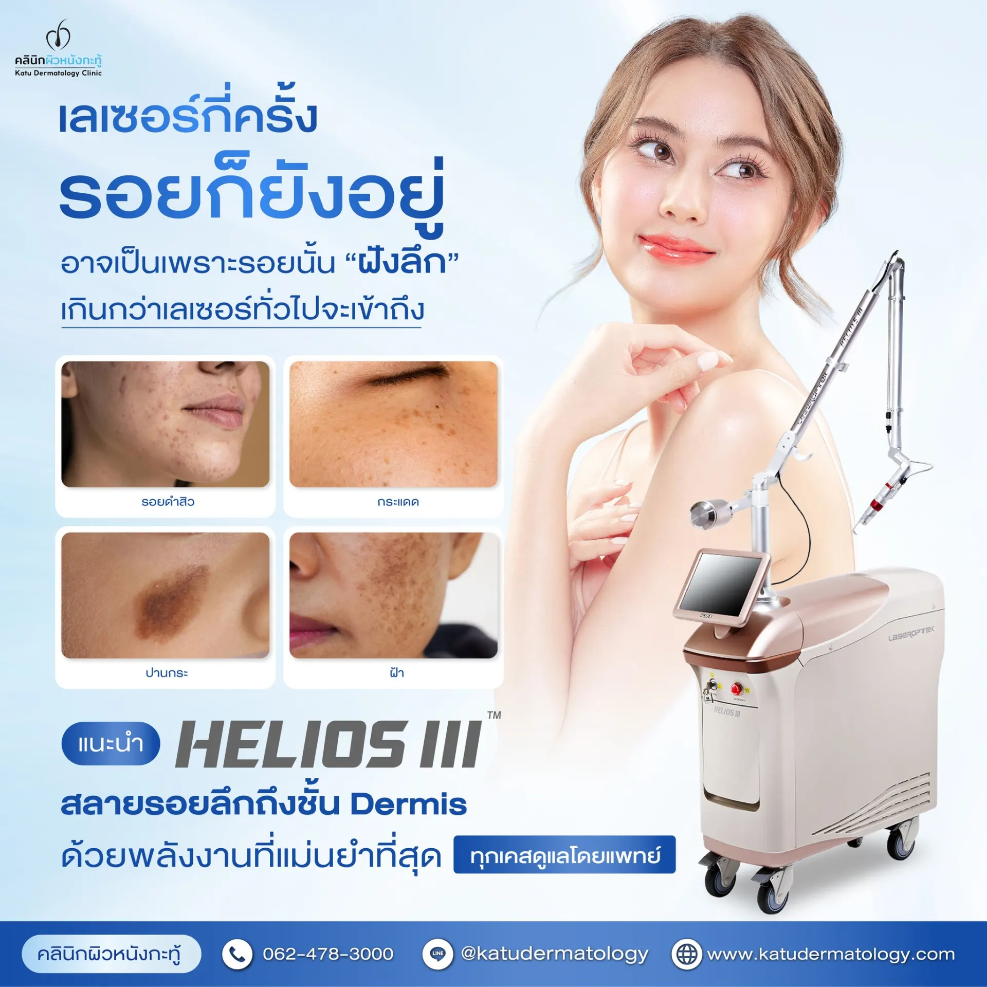Katu Dermatology Clinic คลินิกผิวหนังกะทู้ ดูแลผิว สิว เลเซอร์ และความงามในภูเก็ต