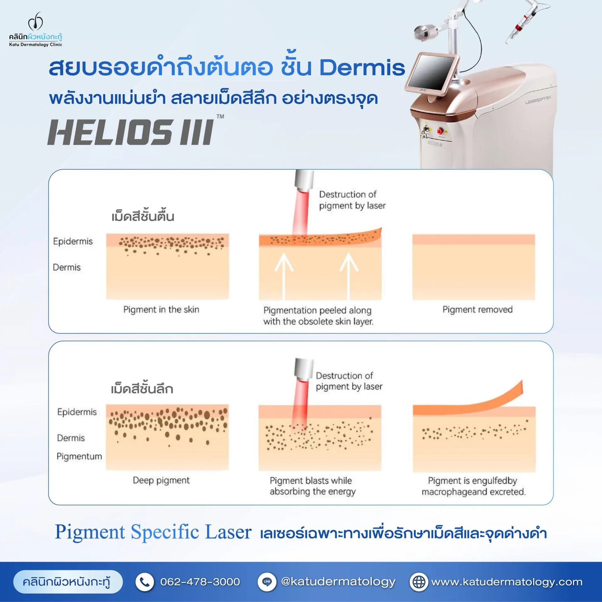 Katu Dermatology Clinic คลินิกผิวหนังกะทู้ ดูแลผิว สิว เลเซอร์ และความงามในภูเก็ต