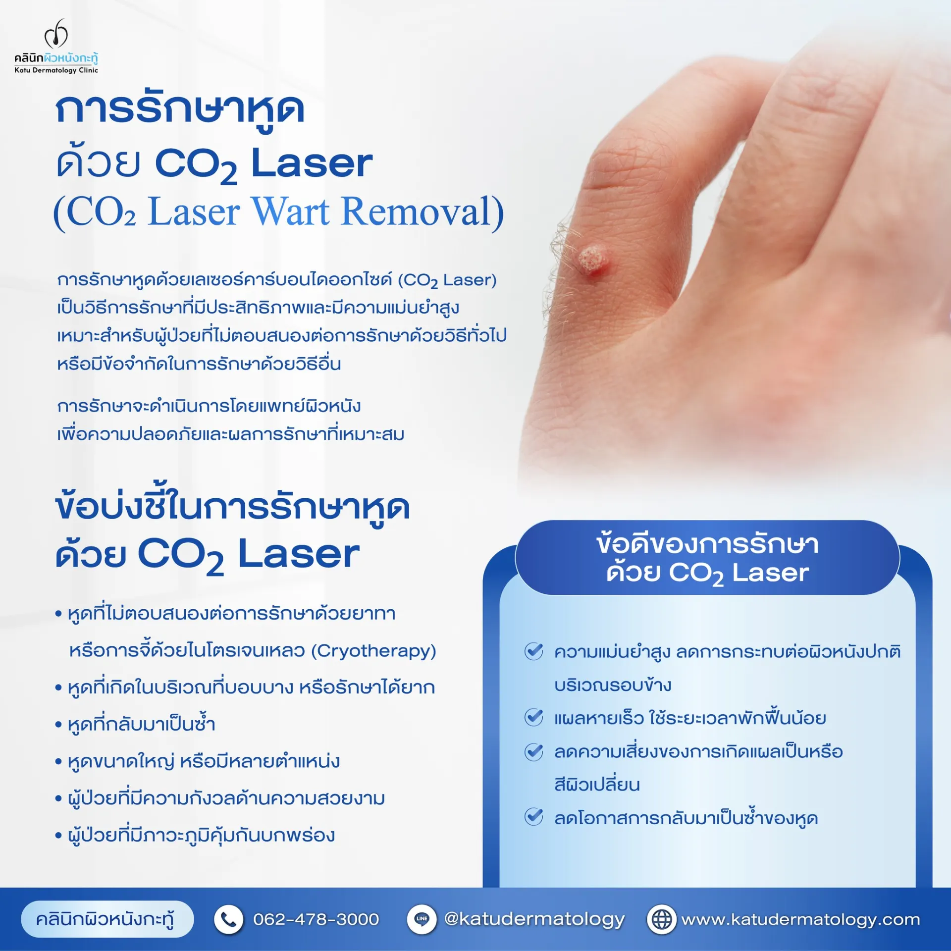 Katu Dermatology Clinic คลินิกผิวหนังกะทู้ ดูแลผิว สิว เลเซอร์ และความงามในภูเก็ต