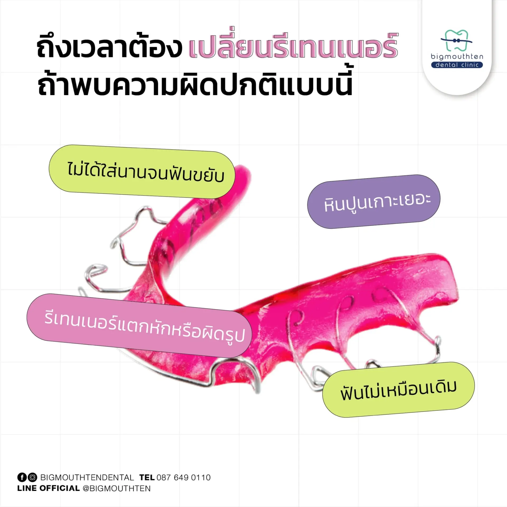 Bigmouthten Dental Clinic คลินิกทันตกรรมเชียงใหม่ จัดฟัน รากฟันเทียม วีเนียร์