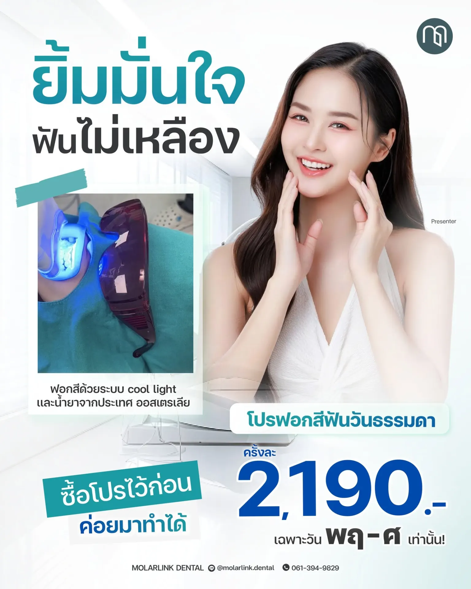 MolarLink Dental คลินิกทันตกรรมโมลาร์ลิงค์ พระราม 2 จัดฟัน รากฟันเทียม วีเนียร์