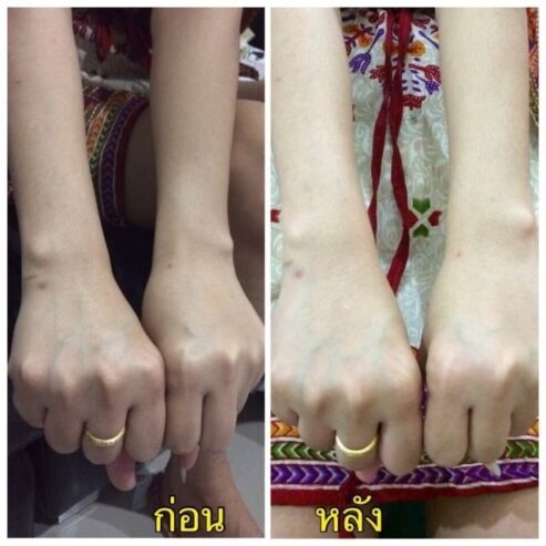เปลี่ยนผิวเสียให้เป็นผิวขาวออร่า