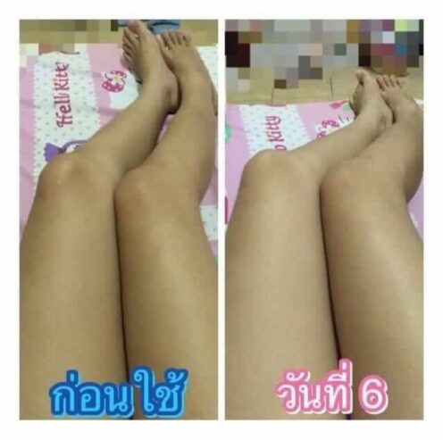เปลี่ยนผิวเสียให้เป็นผิวขาวออร่า